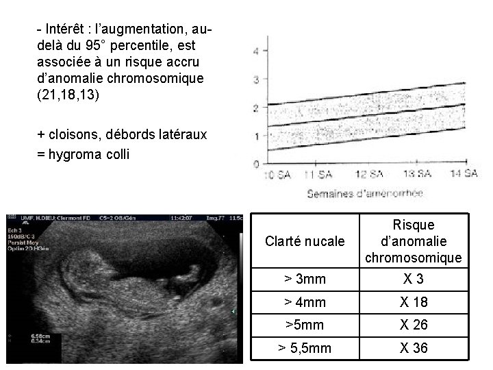 - Intérêt : l’augmentation, audelà du 95° percentile, est associée à un risque accru