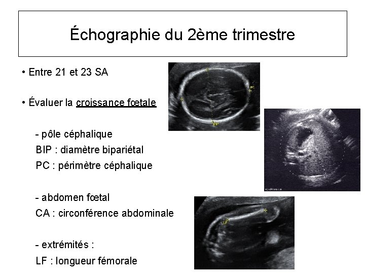 Échographie du 2ème trimestre • Entre 21 et 23 SA • Évaluer la croissance