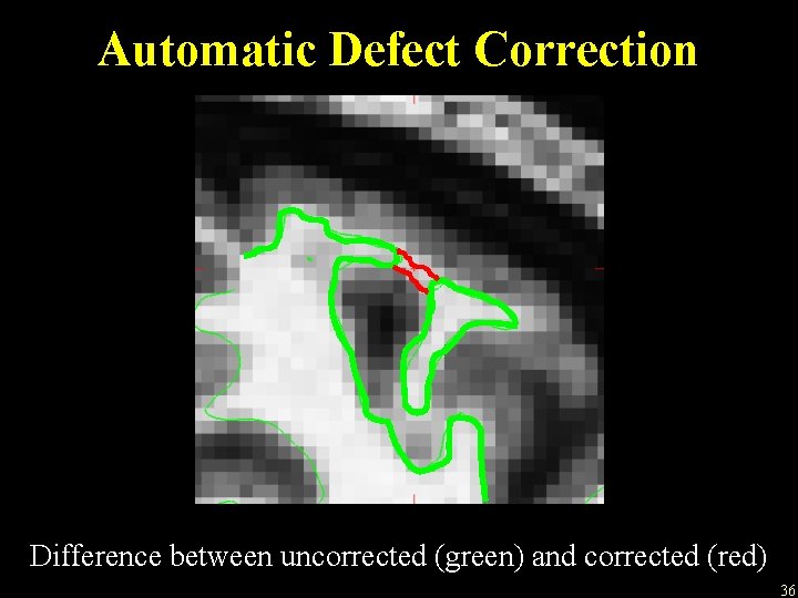 Automatic Defect Correction Difference between uncorrected (green) and corrected (red) 36 