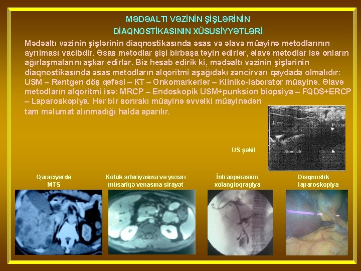 MƏDƏALTI VƏZİNİN ŞİŞLƏRİNİN DİAQNOSTİKASININ XÜSUSİYYƏTLƏRİ Mədəaltı vəzinin şişlərinin diaqnostikasında əsas və əlavə müayinə metodlarının