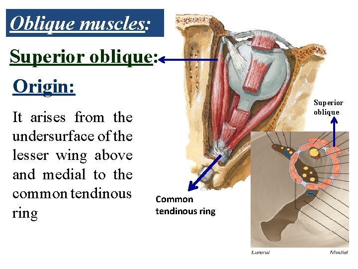 Oblique muscles: Superior oblique: Origin: It arises from the undersurface of the lesser wing