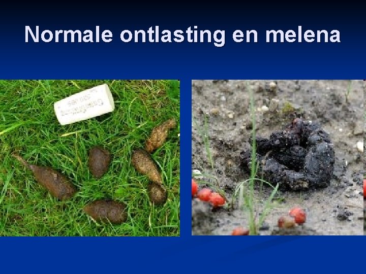 Normale ontlasting en melena 