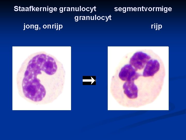 Staafkernige granulocyt segmentvormige granulocyt jong, onrijp 