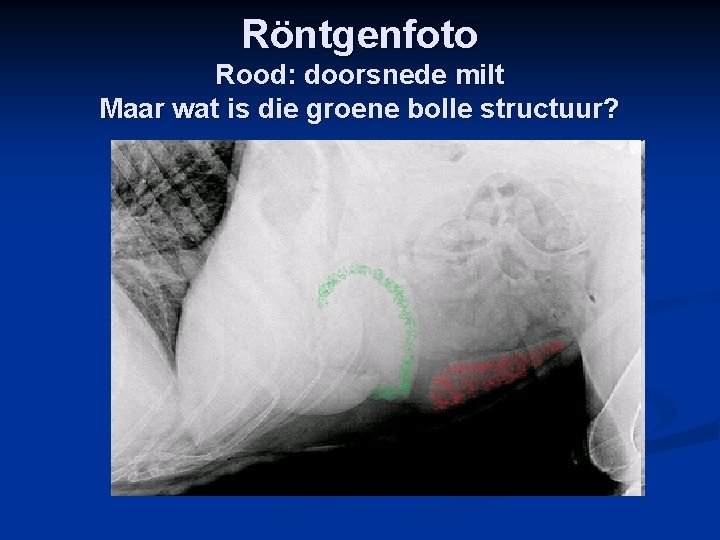 Röntgenfoto Rood: doorsnede milt Maar wat is die groene bolle structuur? 