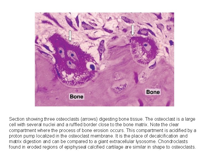 Section showing three osteoclasts (arrows) digesting bone tissue. The osteoclast is a large cell