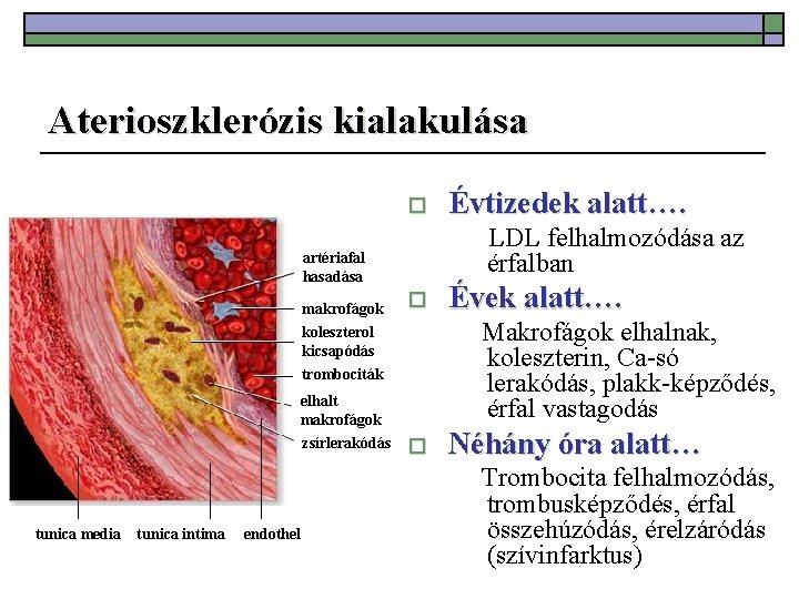 Aterioszklerózis kialakulása o LDL felhalmozódása az érfalban artériafal hasadása makrofágok koleszterol kicsapódás o tunica