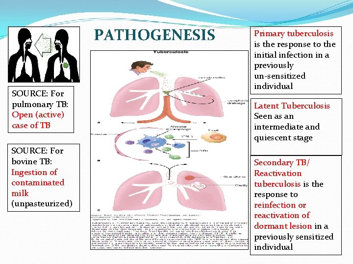 PATHOGENESIS SOURCE: For pulmonary TB: Open (active) case of TB SOURCE: For bovine TB: