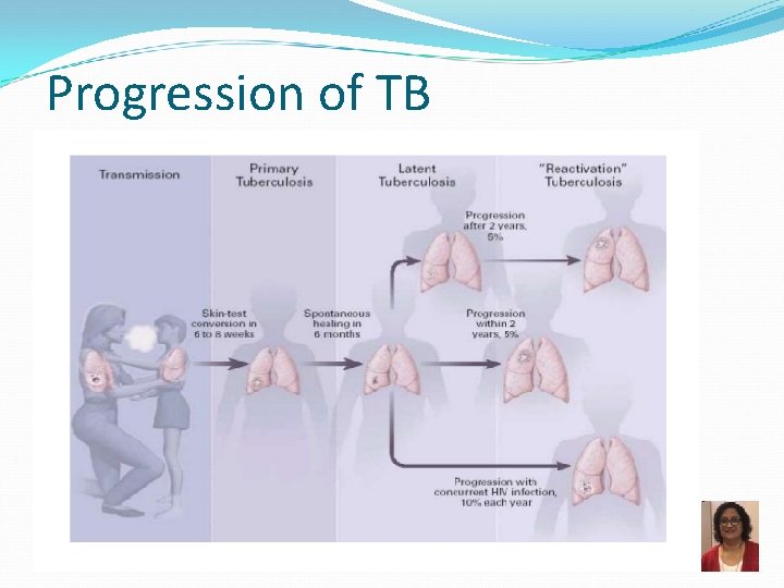 Progression of TB 