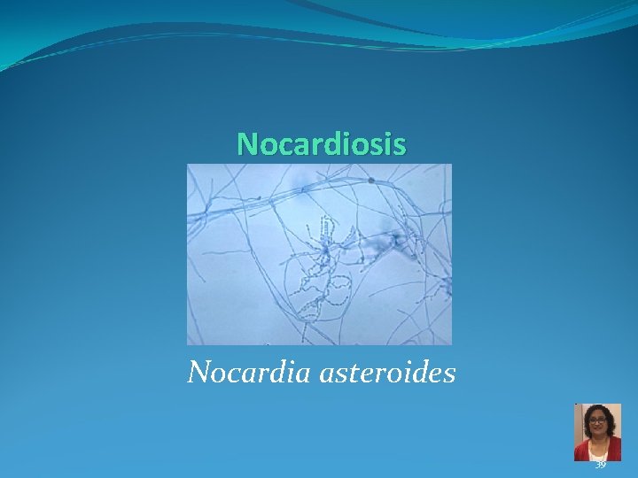 Nocardiosis Nocardia asteroides 39 