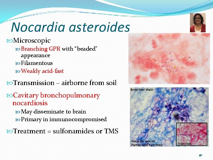 Nocardia asteroides Microscopic Branching GPR with “beaded” appearance Filamentous Weakly acid-fast Transmission – airborne