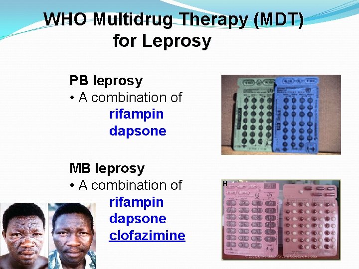 WHO Multidrug Therapy (MDT) for Leprosy PB leprosy • A combination of rifampin dapsone