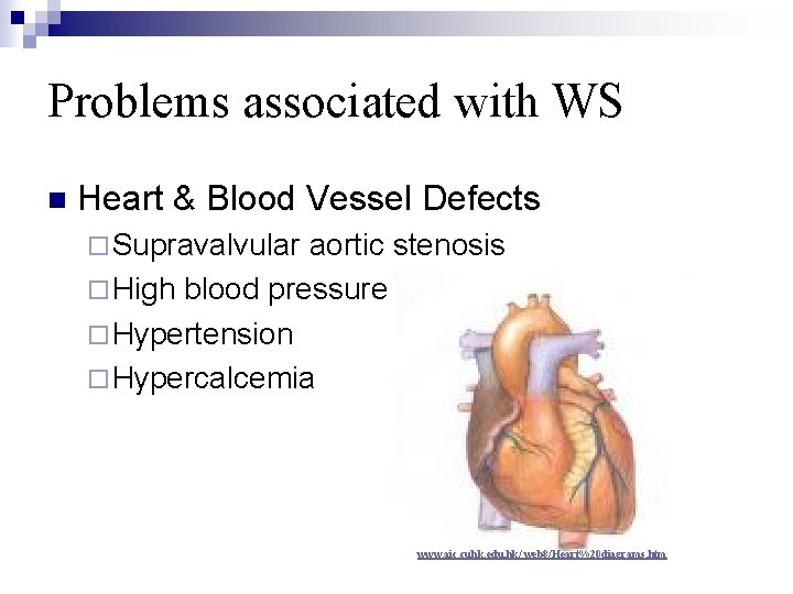 Problems associated with WS n Heart & Blood Vessel Defects ¨ Supravalvular aortic stenosis