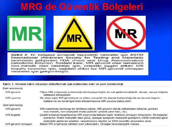 MRG de Güvenlik Bölgeleri 