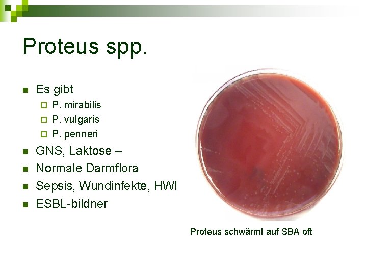 Proteus spp. n Es gibt P. mirabilis ¨ P. vulgaris ¨ P. penneri ¨
