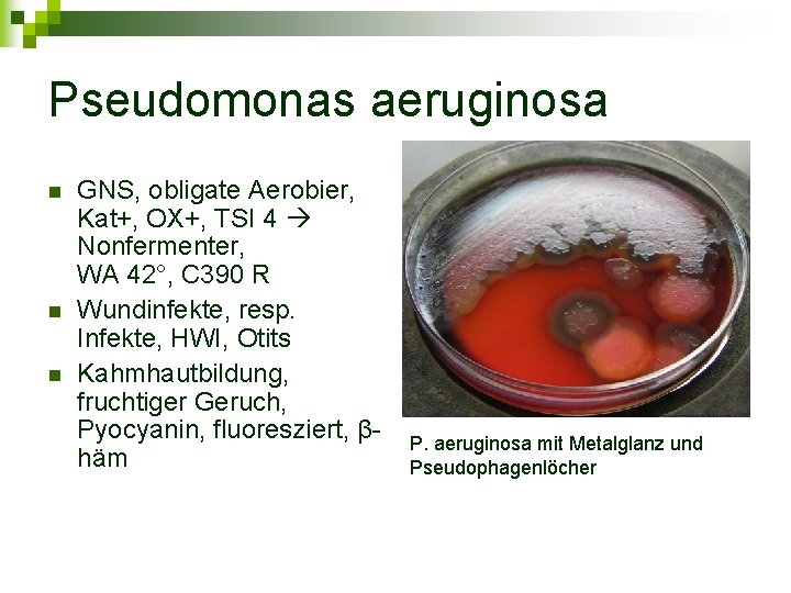 Pseudomonas aeruginosa n n n GNS, obligate Aerobier, Kat+, OX+, TSI 4 Nonfermenter, WA