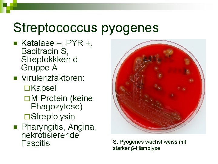 Streptococcus pyogenes n n n Katalase –, PYR +, Bacitracin S, Streptokkken d. Gruppe