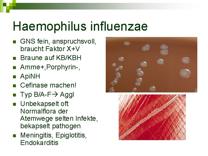 Haemophilus influenzae n n n n GNS fein, anspruchsvoll, braucht Faktor X+V Braune auf