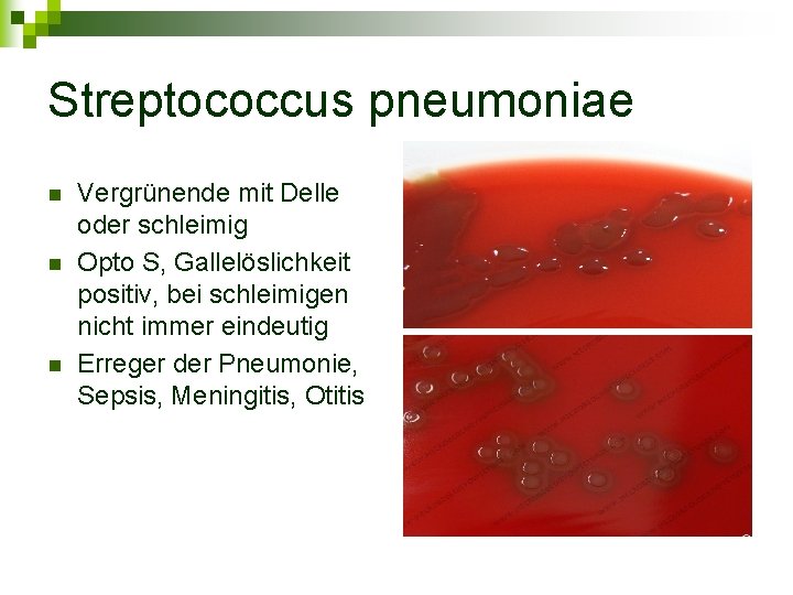 Streptococcus pneumoniae n n n Vergrünende mit Delle oder schleimig Opto S, Gallelöslichkeit positiv,