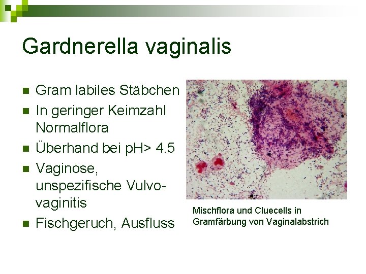 Gardnerella vaginalis n n n Gram labiles Stäbchen In geringer Keimzahl Normalflora Überhand bei