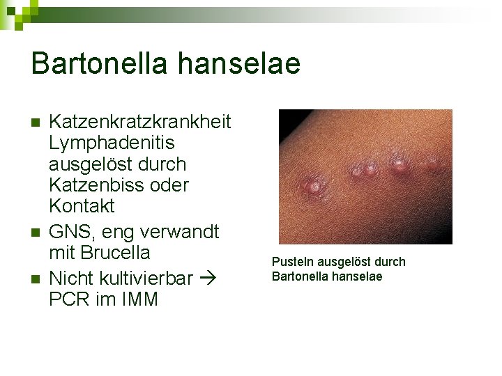 Bartonella hanselae n n n Katzenkratzkrankheit Lymphadenitis ausgelöst durch Katzenbiss oder Kontakt GNS, eng