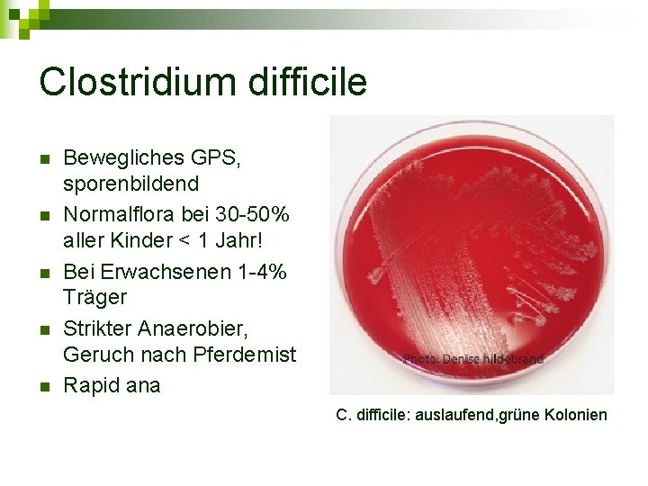 Clostridium difficile n n n Bewegliches GPS, sporenbildend Normalflora bei 30 -50% aller Kinder
