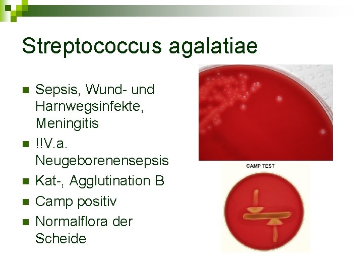 Streptococcus agalatiae n n n Sepsis, Wund- und Harnwegsinfekte, Meningitis !!V. a. Neugeborenensepsis Kat-,