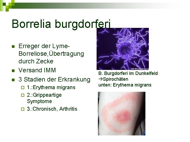 Borrelia burgdorferi n n n Erreger der Lyme. Borreliose, Übertragung durch Zecke Versand IMM