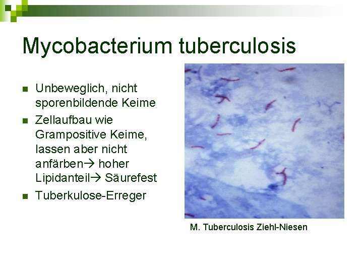 Mycobacterium tuberculosis n n n Unbeweglich, nicht sporenbildende Keime Zellaufbau wie Grampositive Keime, lassen