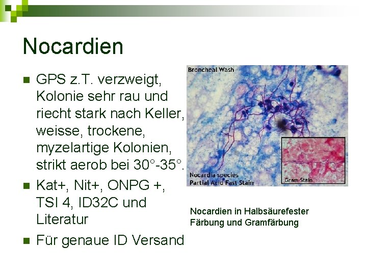 Nocardien n GPS z. T. verzweigt, Kolonie sehr rau und riecht stark nach Keller,