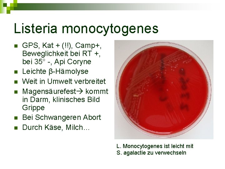 Listeria monocytogenes n n n GPS, Kat + (!!), Camp+, Beweglichkeit bei RT +,