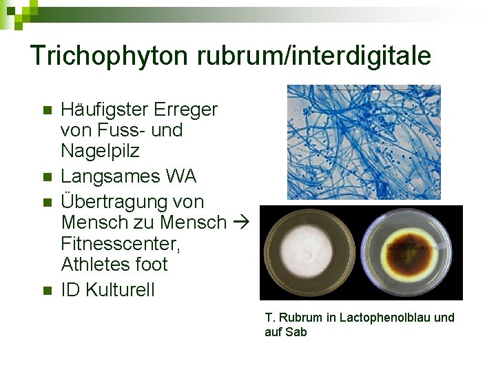 Trichophyton rubrum/interdigitale n n Häufigster Erreger von Fuss- und Nagelpilz Langsames WA Übertragung von