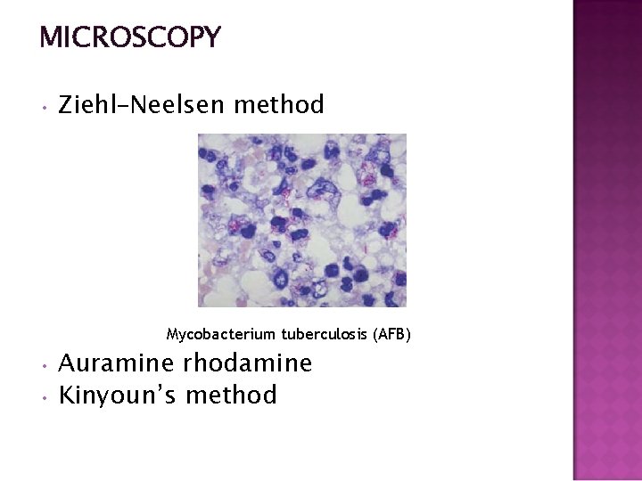 MICROSCOPY • Ziehl–Neelsen method Mycobacterium tuberculosis (AFB) Auramine rhodamine • Kinyoun’s method • 