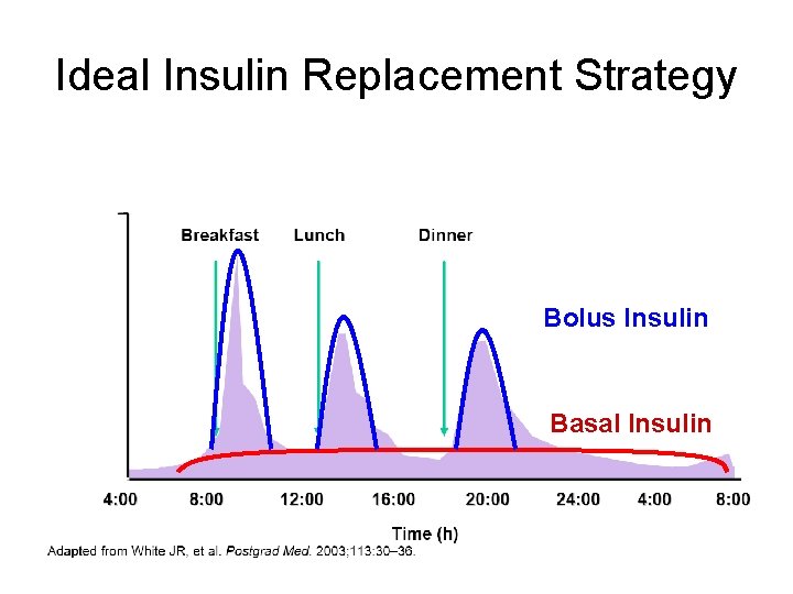 Ideal Insulin Replacement Strategy Bolus Insulin Basal Insulin 