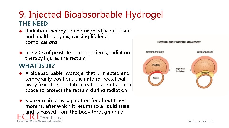 9. Injected Bioabsorbable Hydrogel THE NEED Radiation therapy can damage adjacent tissue and healthy