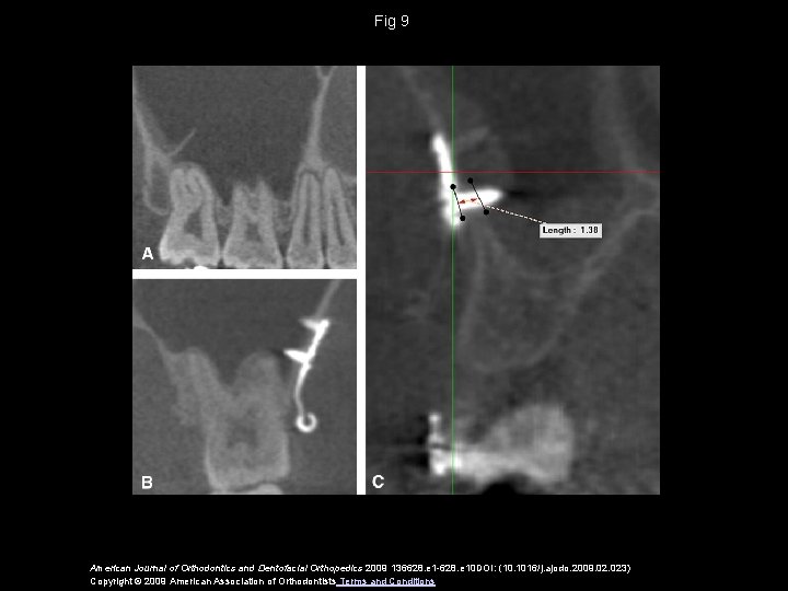 Fig 9 American Journal of Orthodontics and Dentofacial Orthopedics 2009 136628. e 1 -628.