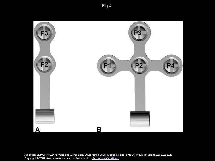 Fig 4 American Journal of Orthodontics and Dentofacial Orthopedics 2009 136628. e 1 -628.