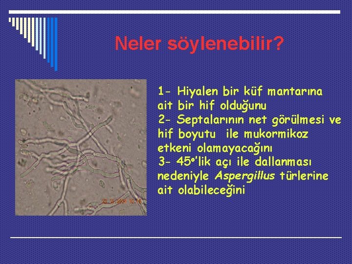 Neler söylenebilir? 1 - Hiyalen bir küf mantarına ait bir hif olduğunu 2 -