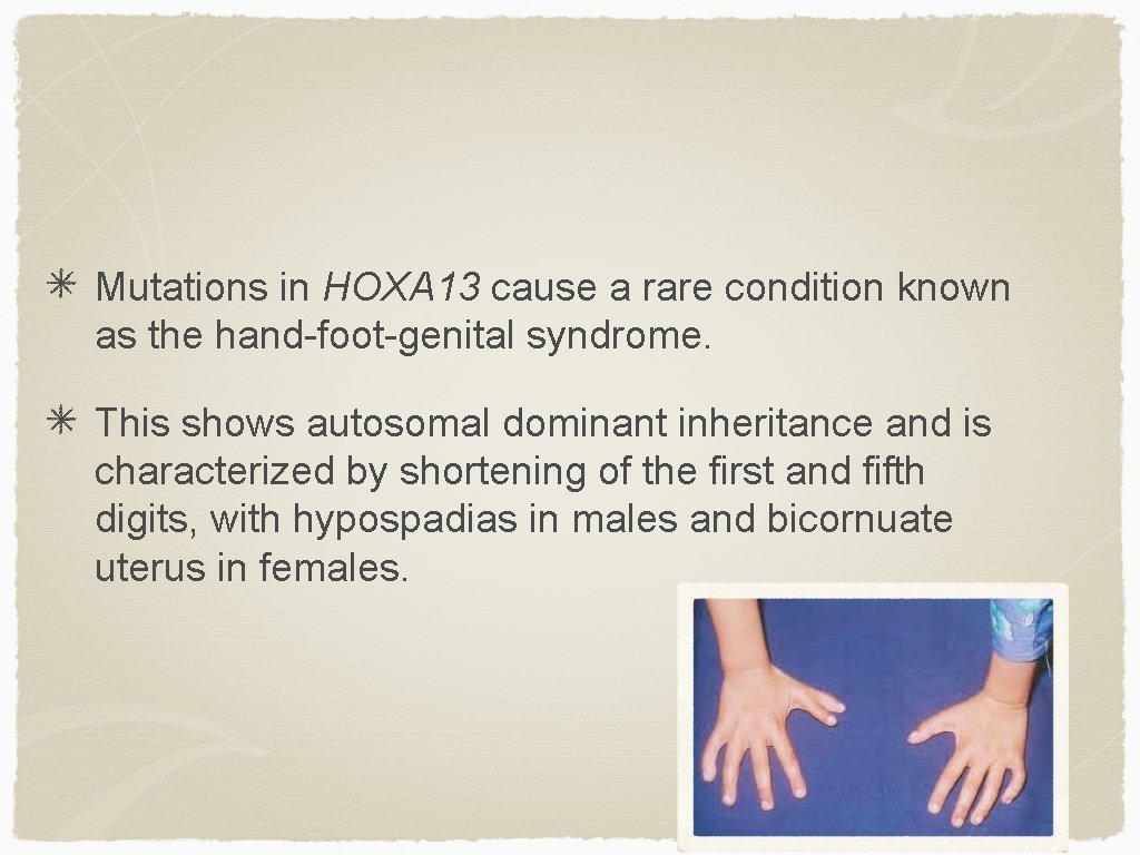 Mutations in HOXA 13 cause a rare condition known as the hand-foot-genital syndrome. This
