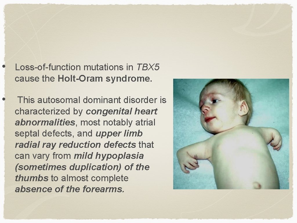  • Loss-of-function mutations in TBX 5 cause the Holt-Oram syndrome. • This autosomal