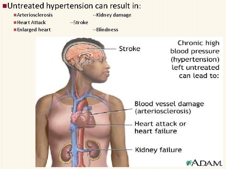 n. Untreated hypertension can result in: n. Arteriosclerosis n. Heart Attack n. Enlarged heart