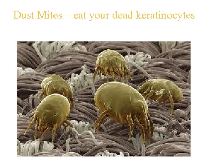 Dust Mites – eat your dead keratinocytes 