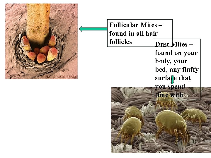 Follicular Mites – found in all hair follicles Dust Mites – found on your