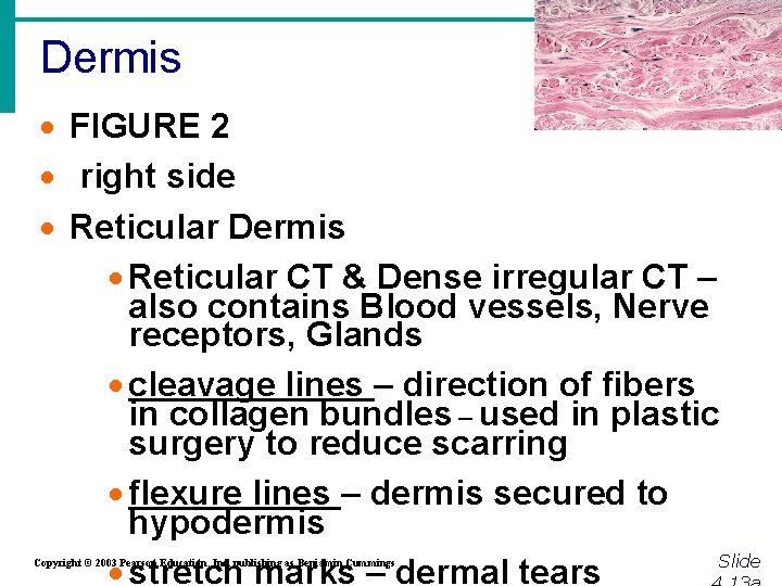 Dermis · FIGURE 2 · right side · Reticular Dermis · Reticular CT &