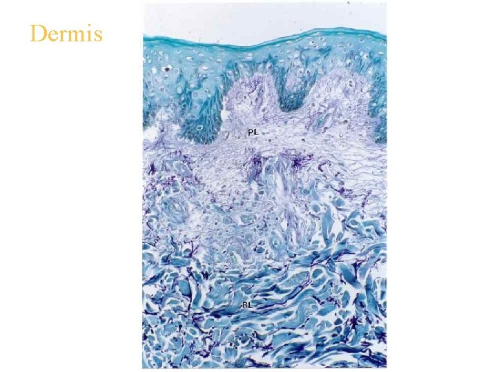 Dermis 