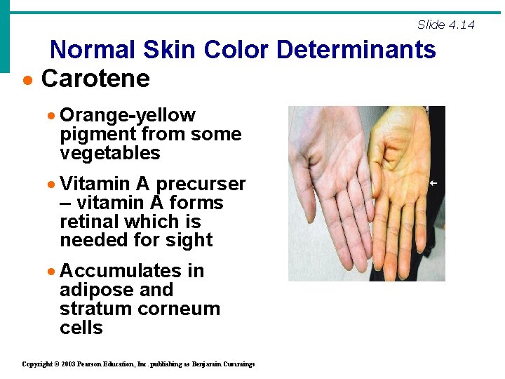 Slide 4. 14 Normal Skin Color Determinants · Carotene · Orange-yellow pigment from some