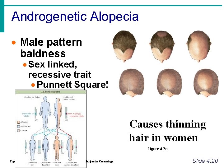 Androgenetic Alopecia · Male pattern baldness · Sex linked, recessive trait · Punnett Square!