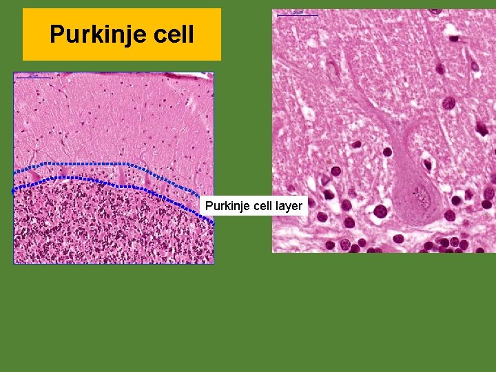 Purkinje cell layer 