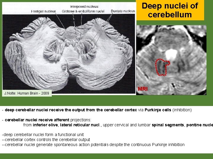 Deep nuclei of cerebellum J. Nolte: Human Brain - 2009 MRI - deep cerebellar