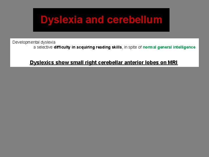 Dyslexia and cerebellum Developmental dyslexia a selective difficulty in acquiring reading skills, in spite