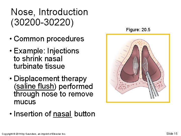 Nose, Introduction (30200 -30220) Figure: 20. 5 • Common procedures • Example: Injections to
